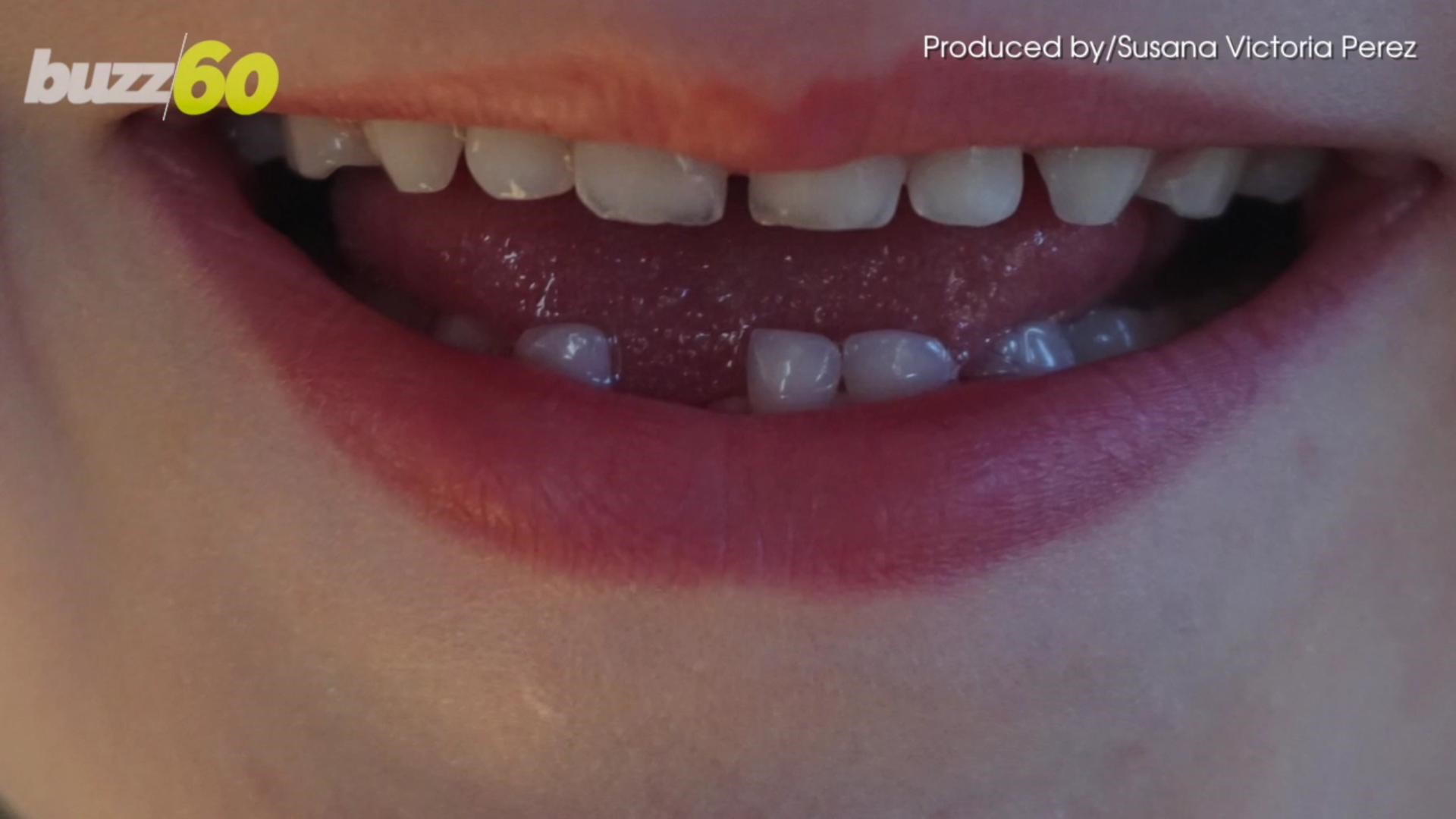 10 Epic Videos Of Kids Pulling Teeth In Crazy Ways On Tooth Fairy Day Kare11 Com