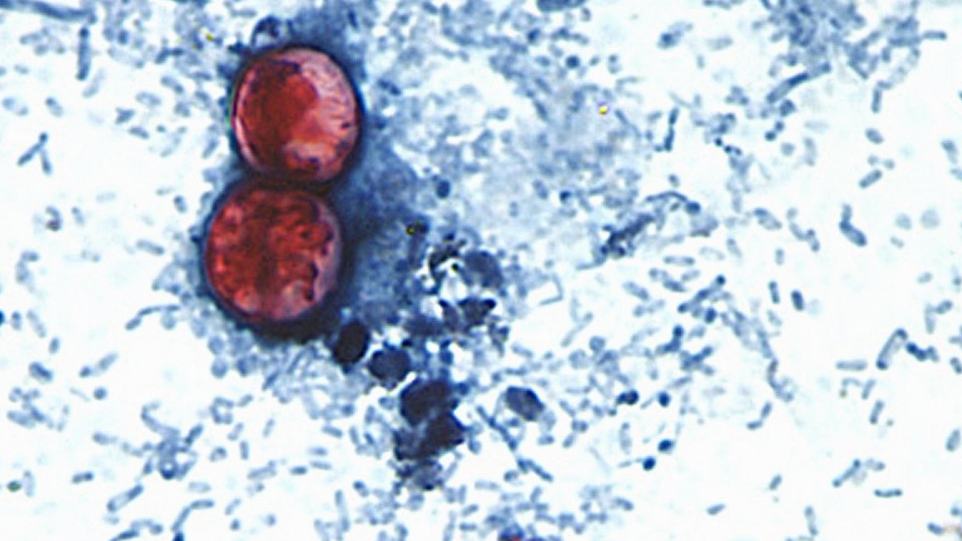 Salmonella and cyclosporiasis: How to tell the difference between the foodborne illnesses