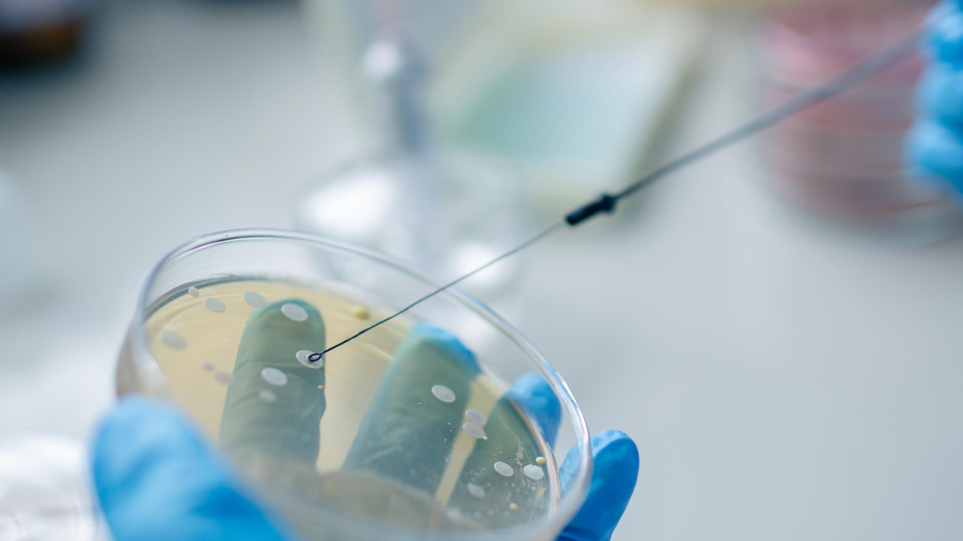 Scientists trained AI to invent 16 new viruses that don't exist in nature