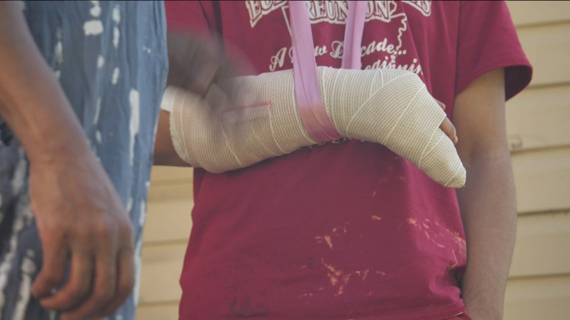 Pitbull attacks owners in northeast Minneapolis