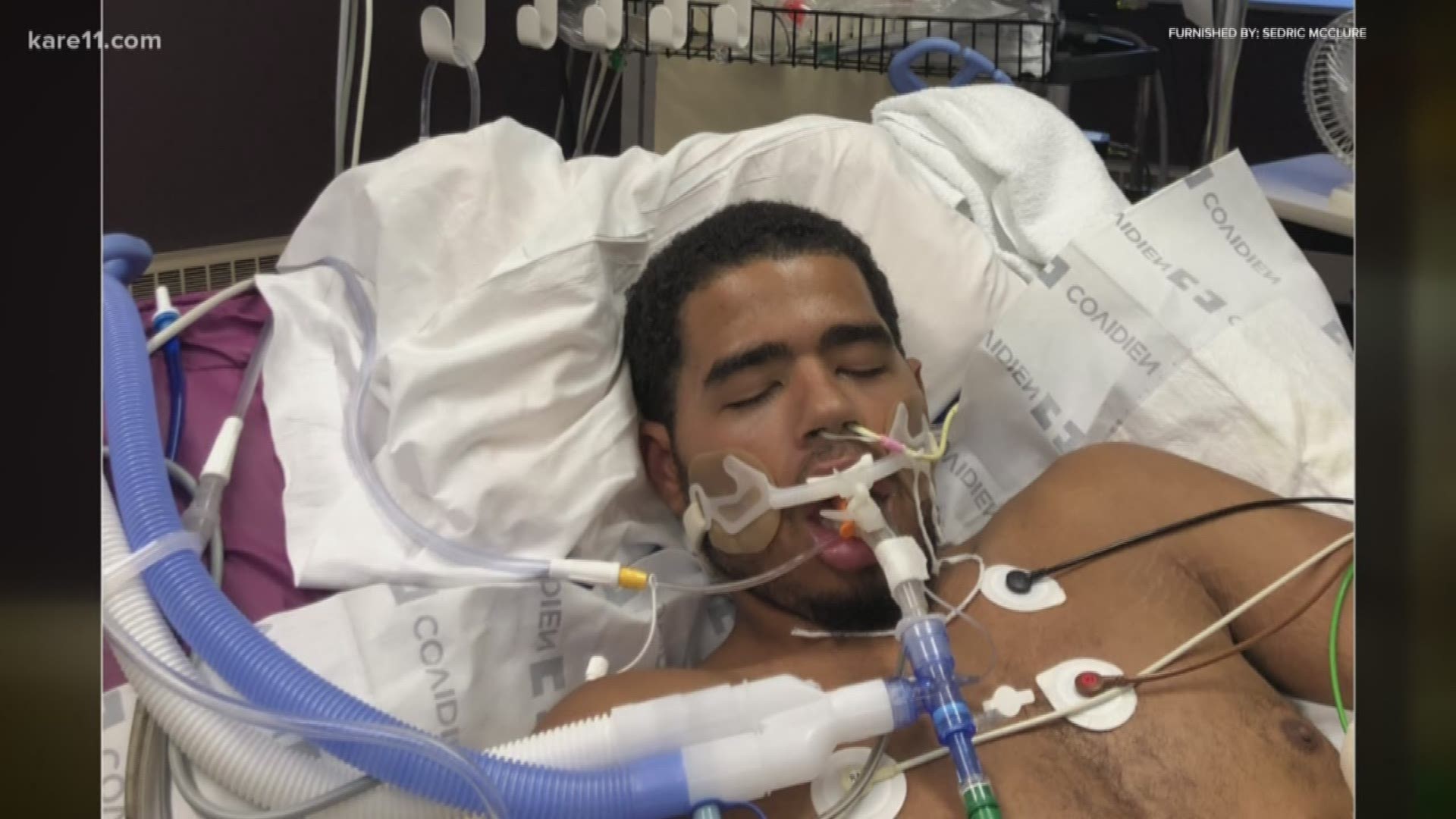 The parents of a 21-year-old man from Brooklyn Park say he's among a growing number people suffering from severe lung injury linked to vaping.