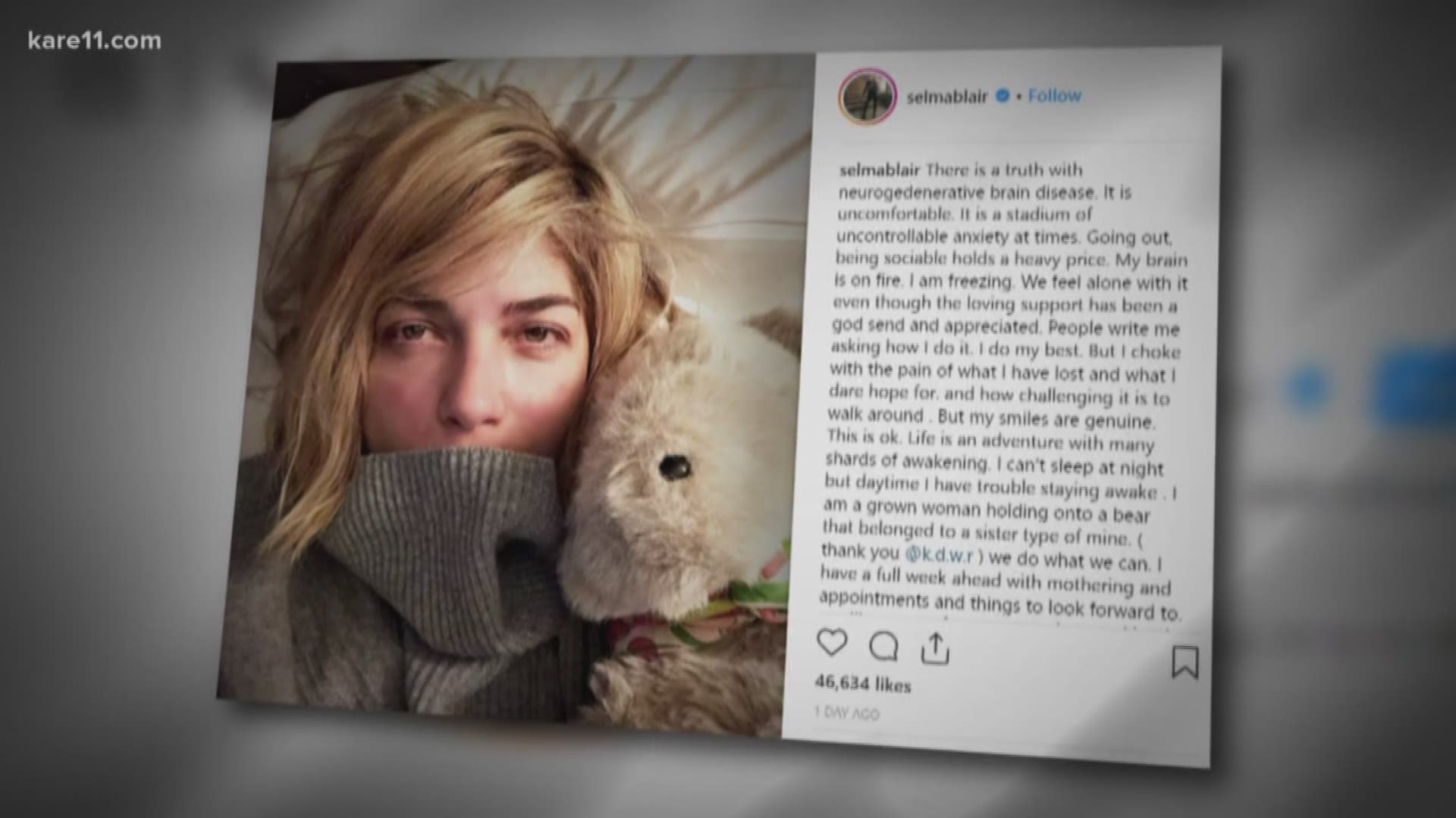 Actress Selma Blair is among the millions of folks living with MS - and she's not doing it in secret - sharing her journey almost daily on social media. https://kare11.tv/2FCE8ag