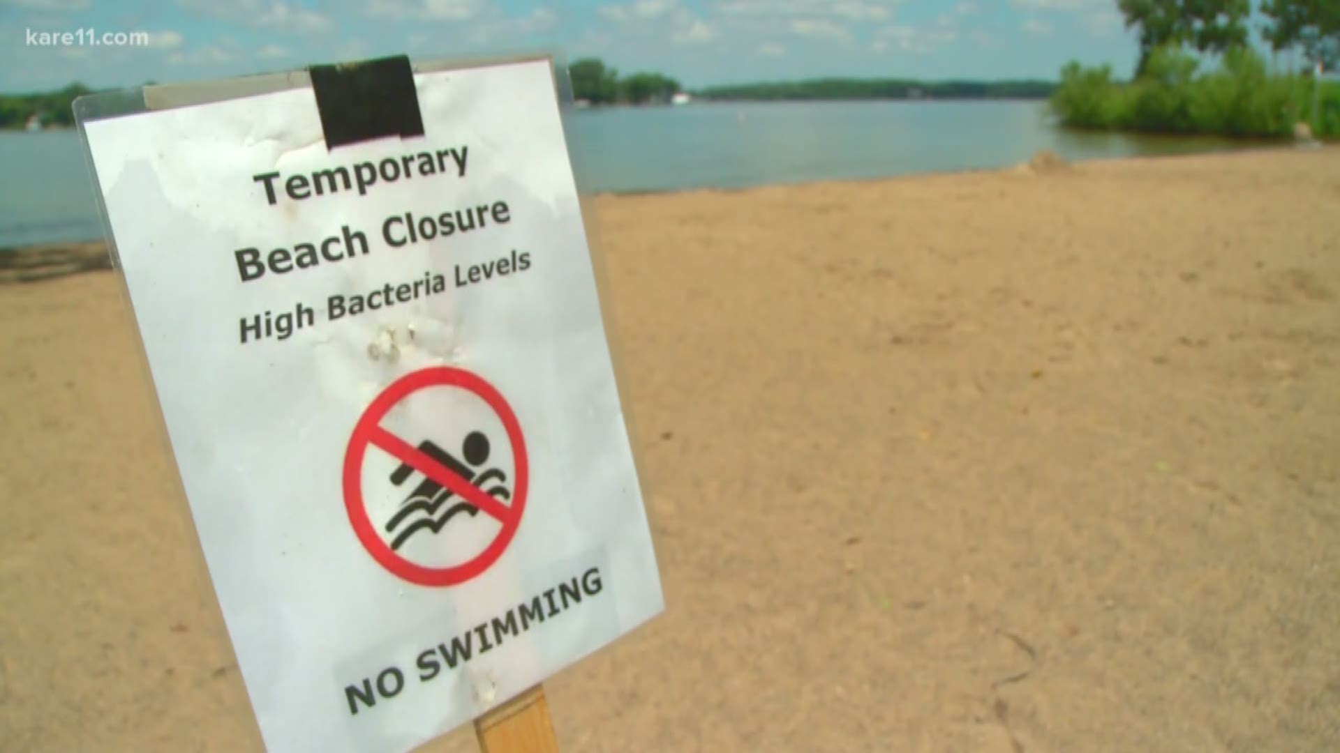 Hennepin County health leaders say more than 100 people got sick after visiting Big Island during the 4th of July.