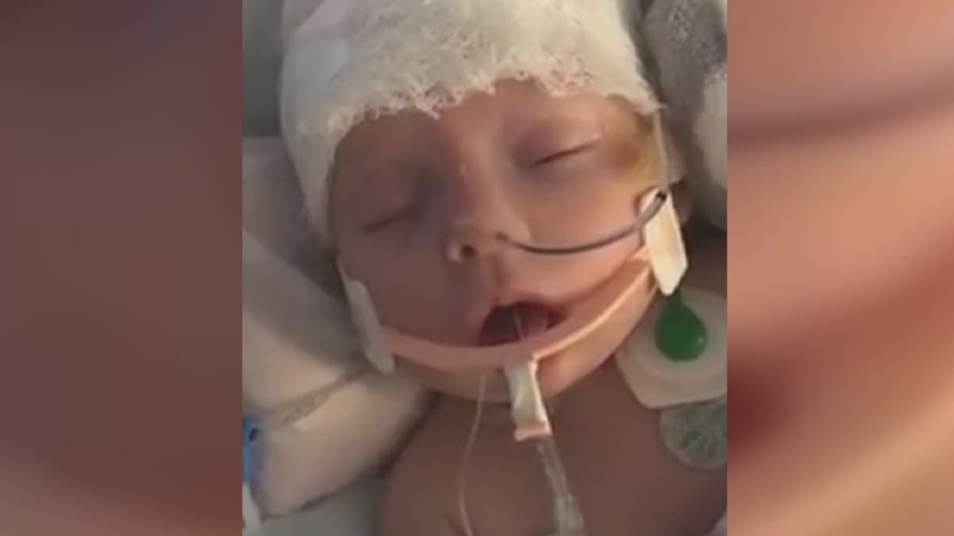 A baby recovering months after being hit on the head by a softball is going home. KWWL's Jessica Hartman has the latest on baby McKenna's recovery.