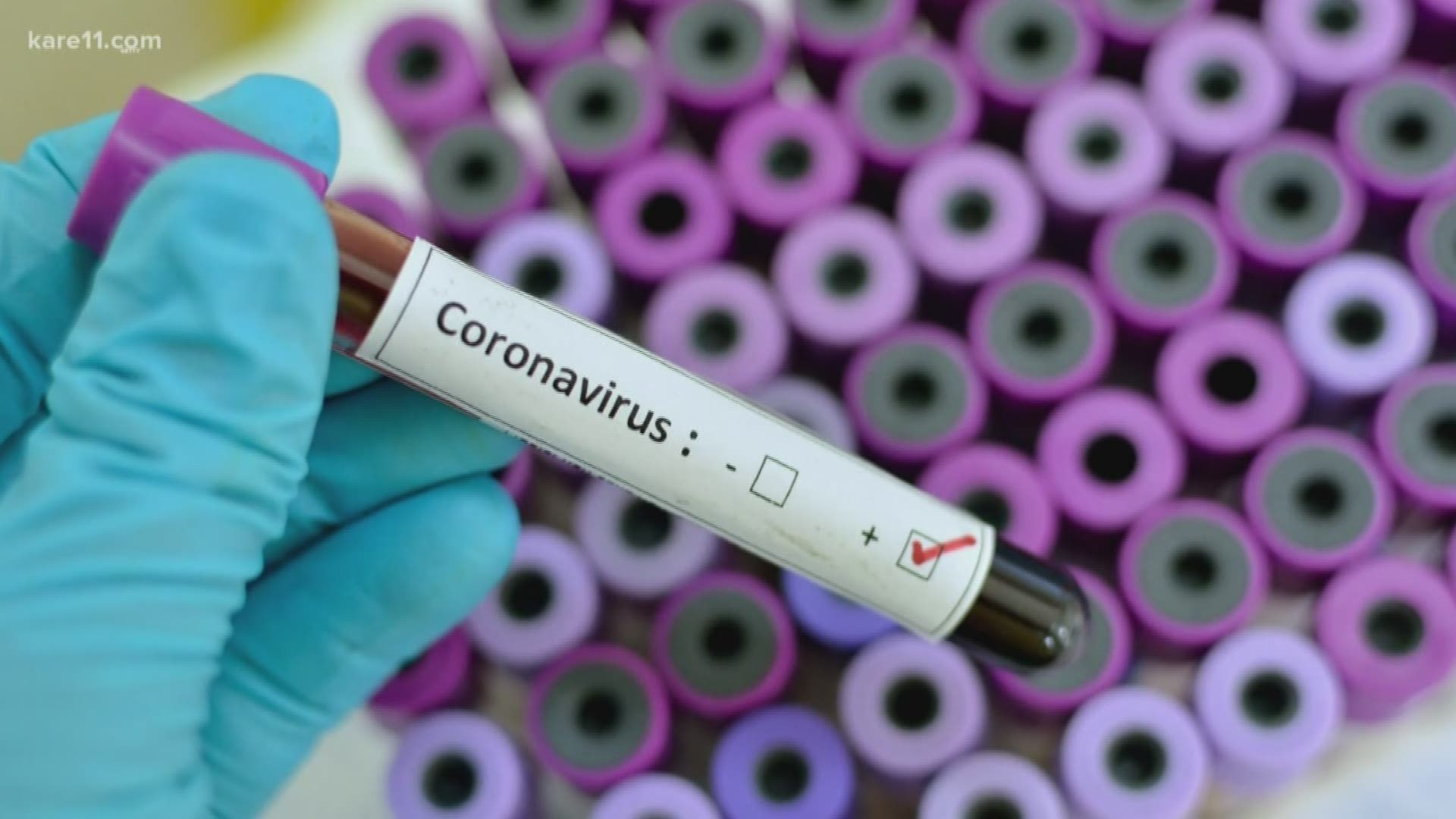 With the first confirmed case of Coronavirus in the U.S. should we be worried about an outbreak here?