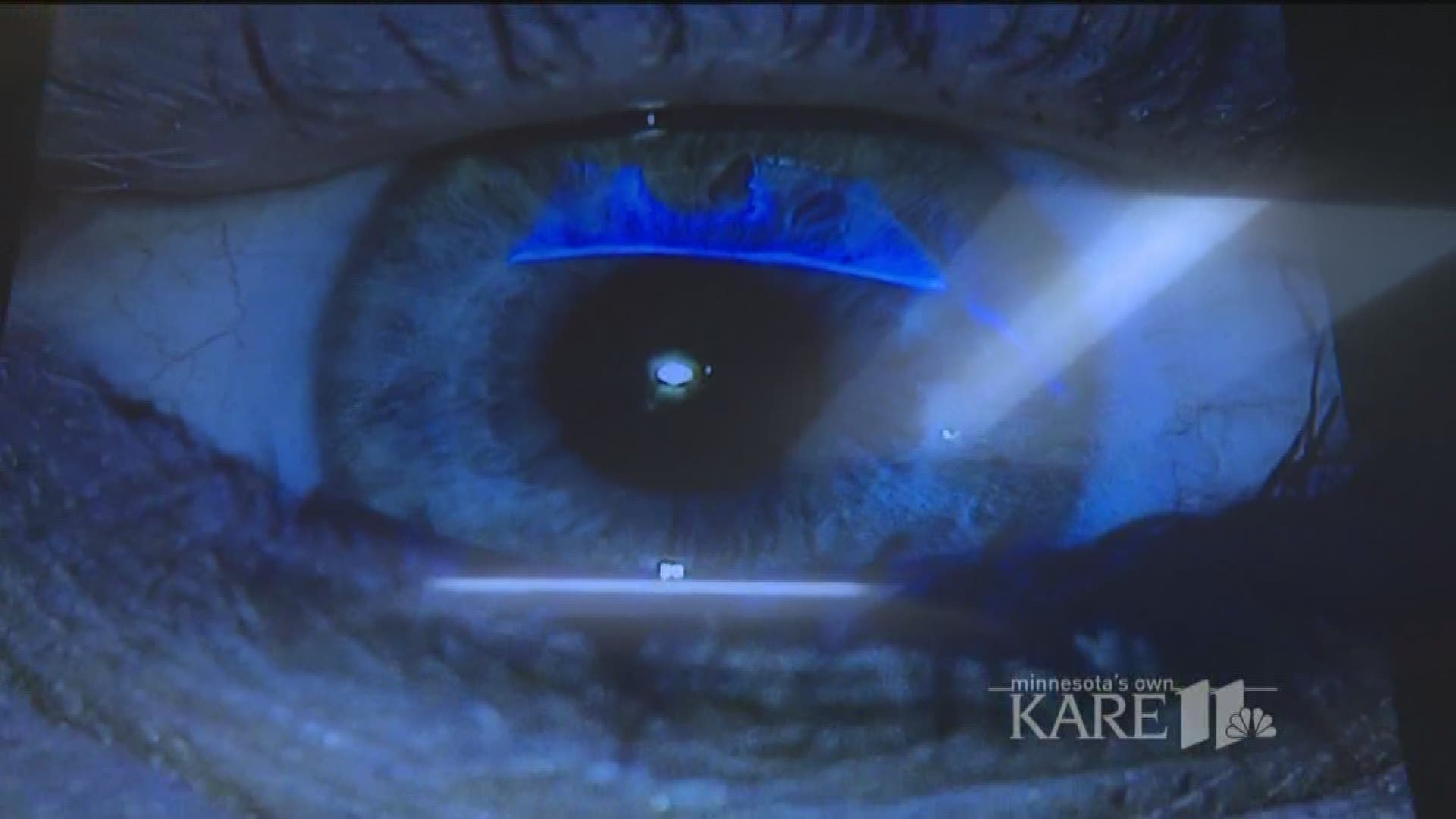 You've heard of Lasik. But have you heard of Smile? It's a new type of technology to correct your vision, and it's only offered at 30 places in the country. Bloomington is one of them. http://kare11.tv/2vcPFVU