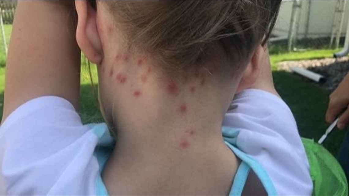 Twin Cities swarming with bumper crop of gnats | kare11.com