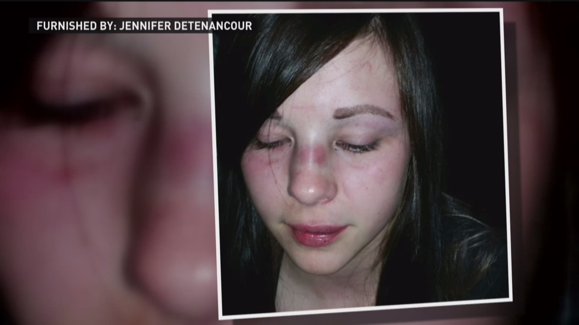 St. Francis teen brutally attacked