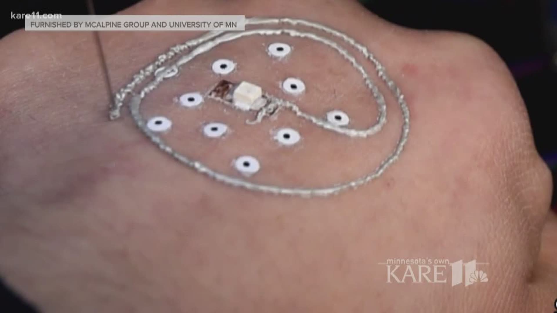 U of M: 3D print electronics right onto your skin
