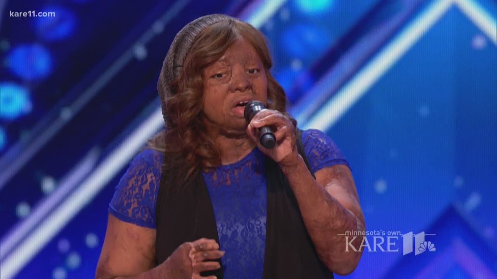 Kechi Okwuchi had every reason to become jaded and bitter after a plane crash left the Nigeria native severely burned. Instead, she turned to music, and made her recovery an inspiration to others.