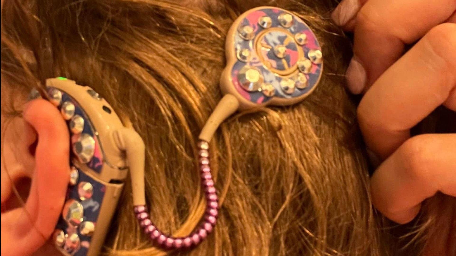 Missing Ear Protection Child's lost hearing device found | kare11.com