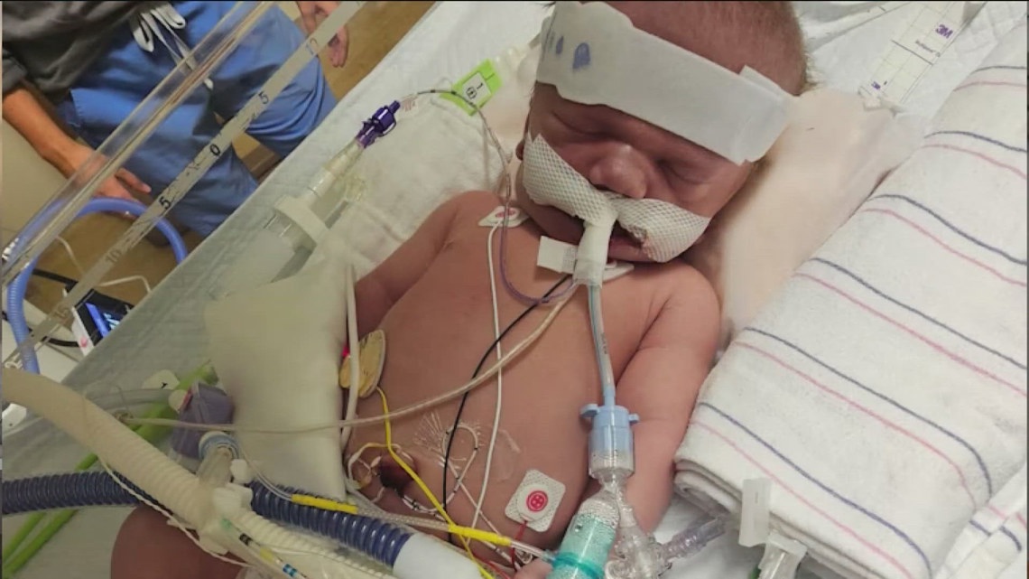 Minnesota doctors complete first partial heart transplant on infant in Upper Midwest