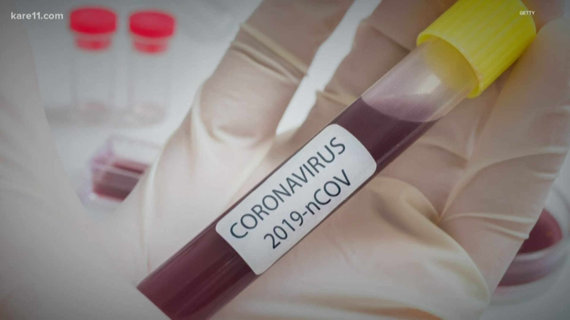 The Minnesota Department of Health confirmed Sunday a second presumptive positive case of novel coronavirus in the state.