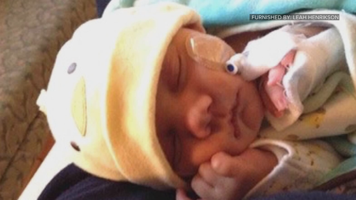 MN becomes first state to universally screen newborns for CMV - Vimarsana News