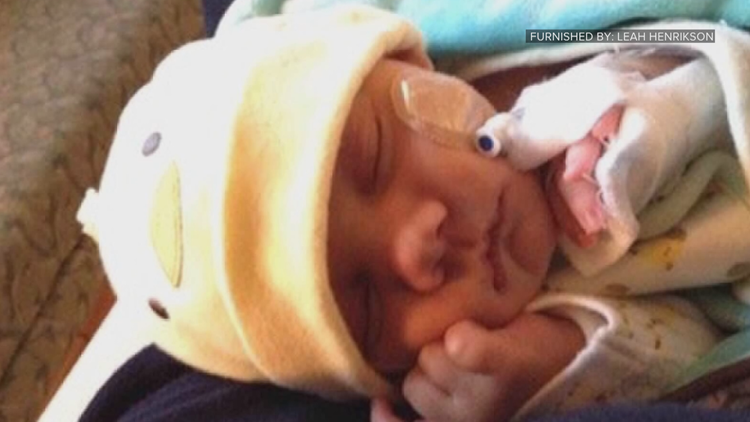 Minnesota becomes first state to screen newborns for CMV