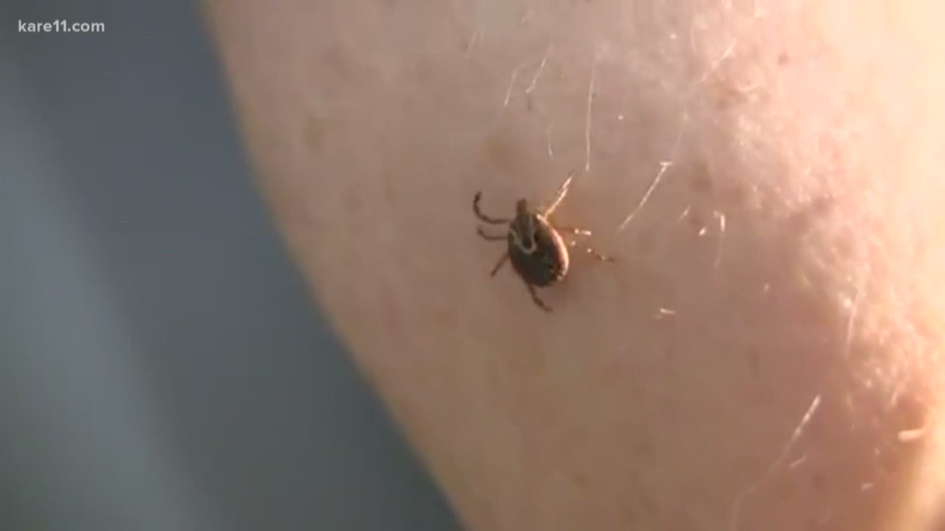 ??????According to a new report from the Centers for Disease Control (CDC), Minnesota is at the epicenter of tick-related illness. https://kare11.tv/2K0O5kB