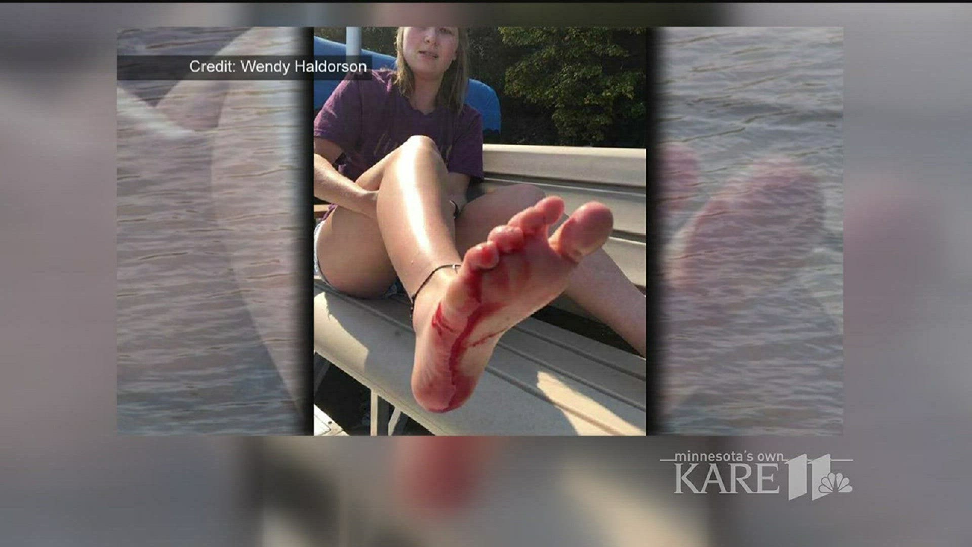 For the second time in less than two months, a muskie has attacked someone on the same northern Minnesota lake. Twenty-two-year-old Paige Dougherty's foot was bitten Sunday afternoon on Island Lake, while she was dangling her feet in the water. http://kar