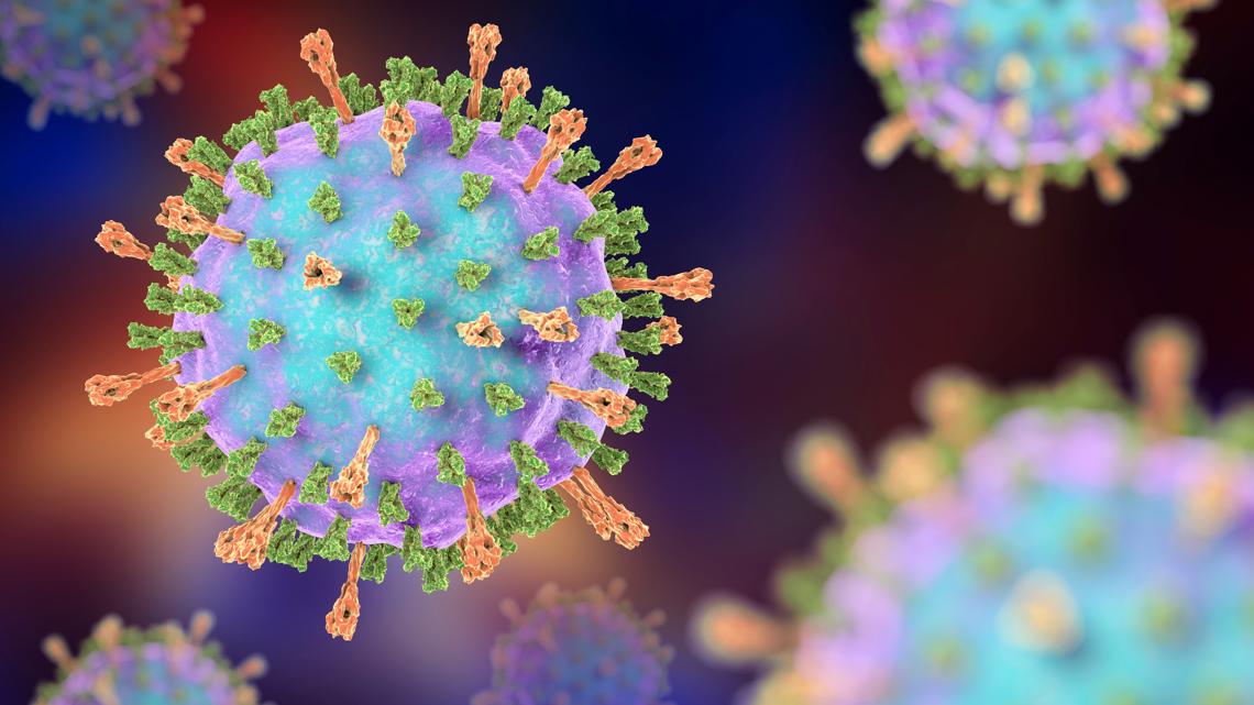 Ramsey County confirms first mumps case in 5 years