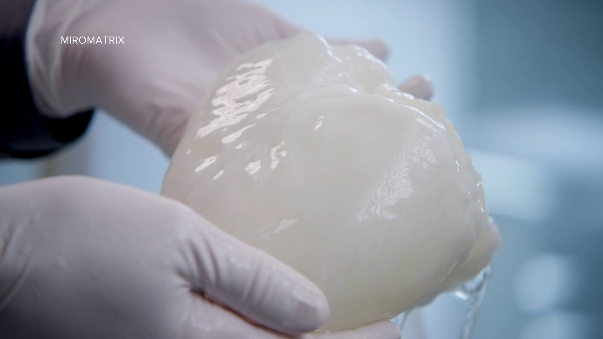 Eden Prairie-based Miromatrix will attempt the first-ever bioengineered organ transplant into a human.