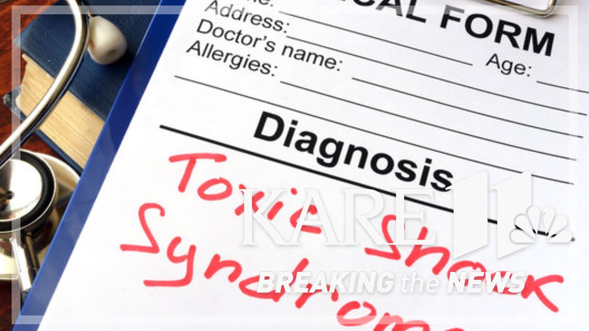 The Wisconsin Department of Health Services says toxic shock syndrome is a serious illness caused by bacteria that can produce toxins.