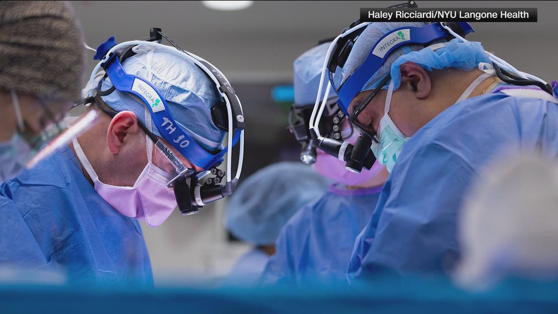Health experts say it's an amazing accomplishment in the world of surgery.
