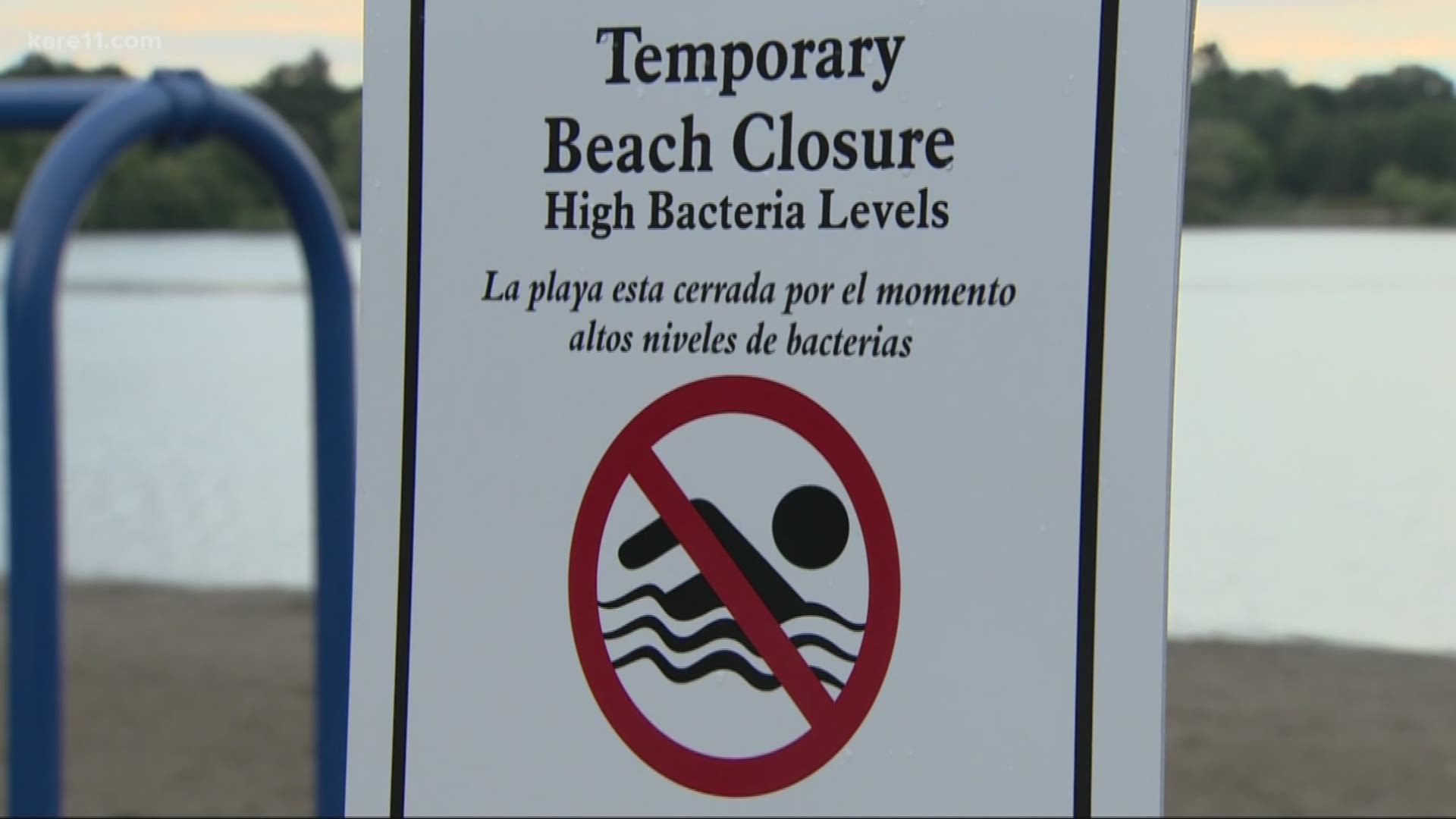 Officials are set to close two Lake Nokomis beaches due to E. Coli concerns regarding three children who recently swam at the beach.