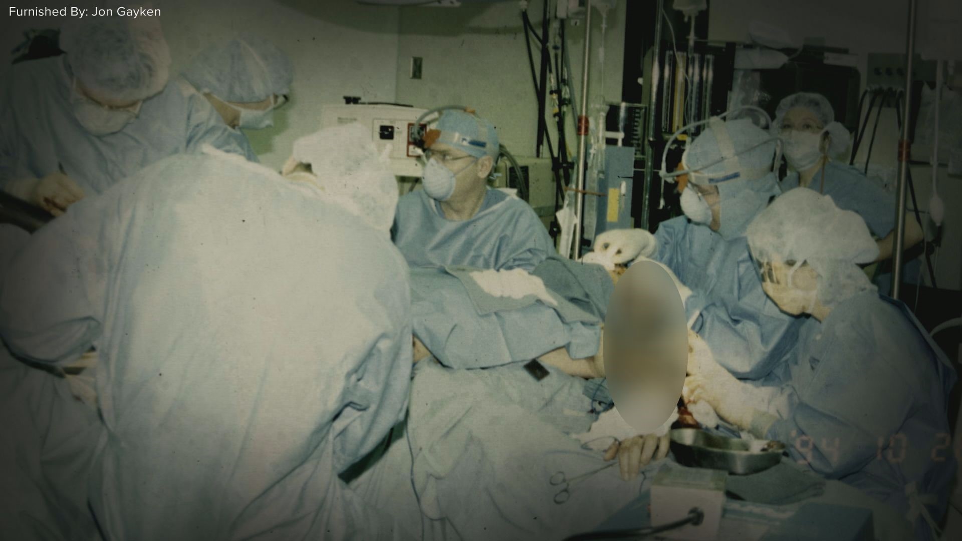 Local burn surgeon works in unit where he was once a patient | kare11.com