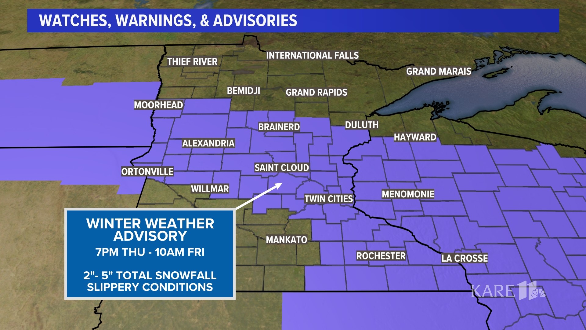 For sale A look inside the 'Double Domes' home in Eden Prairie