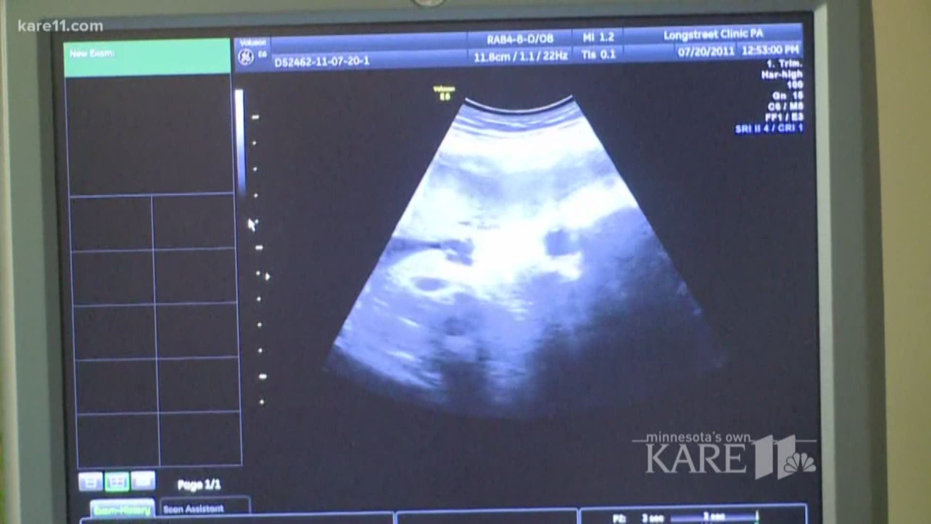 The Minnesota House Thursday passed a bill that would require physicians to tell women getting abortions that they can see the ultrasound before starting the operation.
