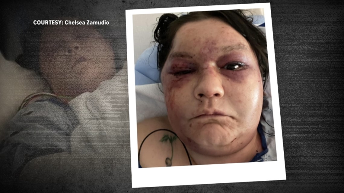 KARE 11 Investigates: Woman left for dead says courts failed her - Vimarsana News
