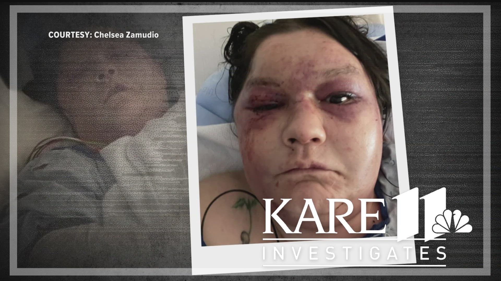 KARE 11 obtained a chilling recorded confession from a man accused of brutally beating his ex-girlfriend – just hours after pleading guilty to an earlier attack.