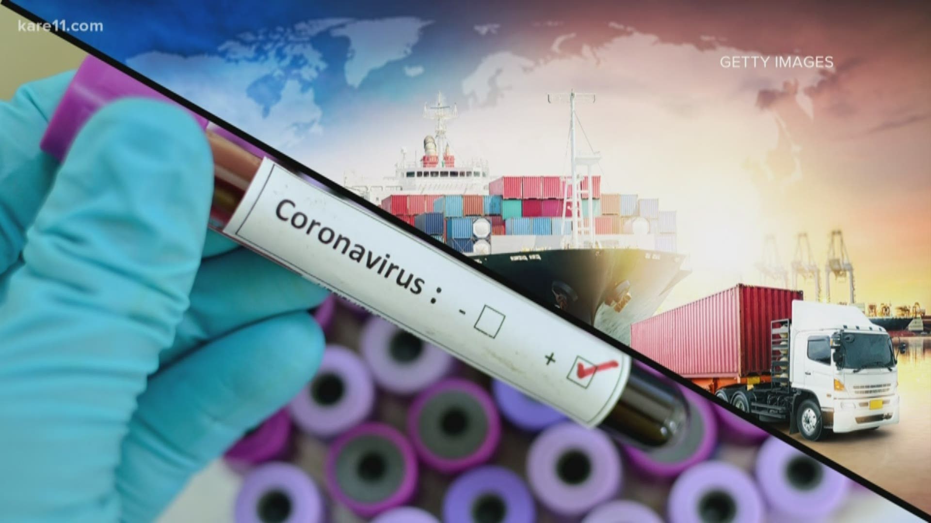 What is happening in China will affect us here too.  Illnesses like the coronavirus could disrupt supply chains.