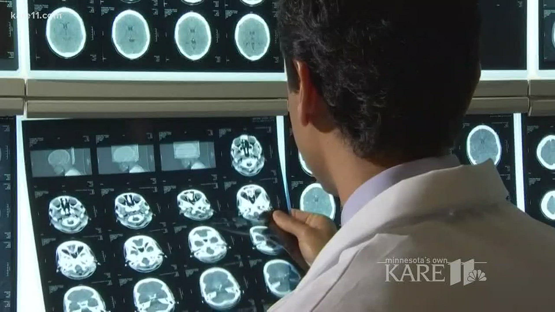 Blood test helping diagnose concussions