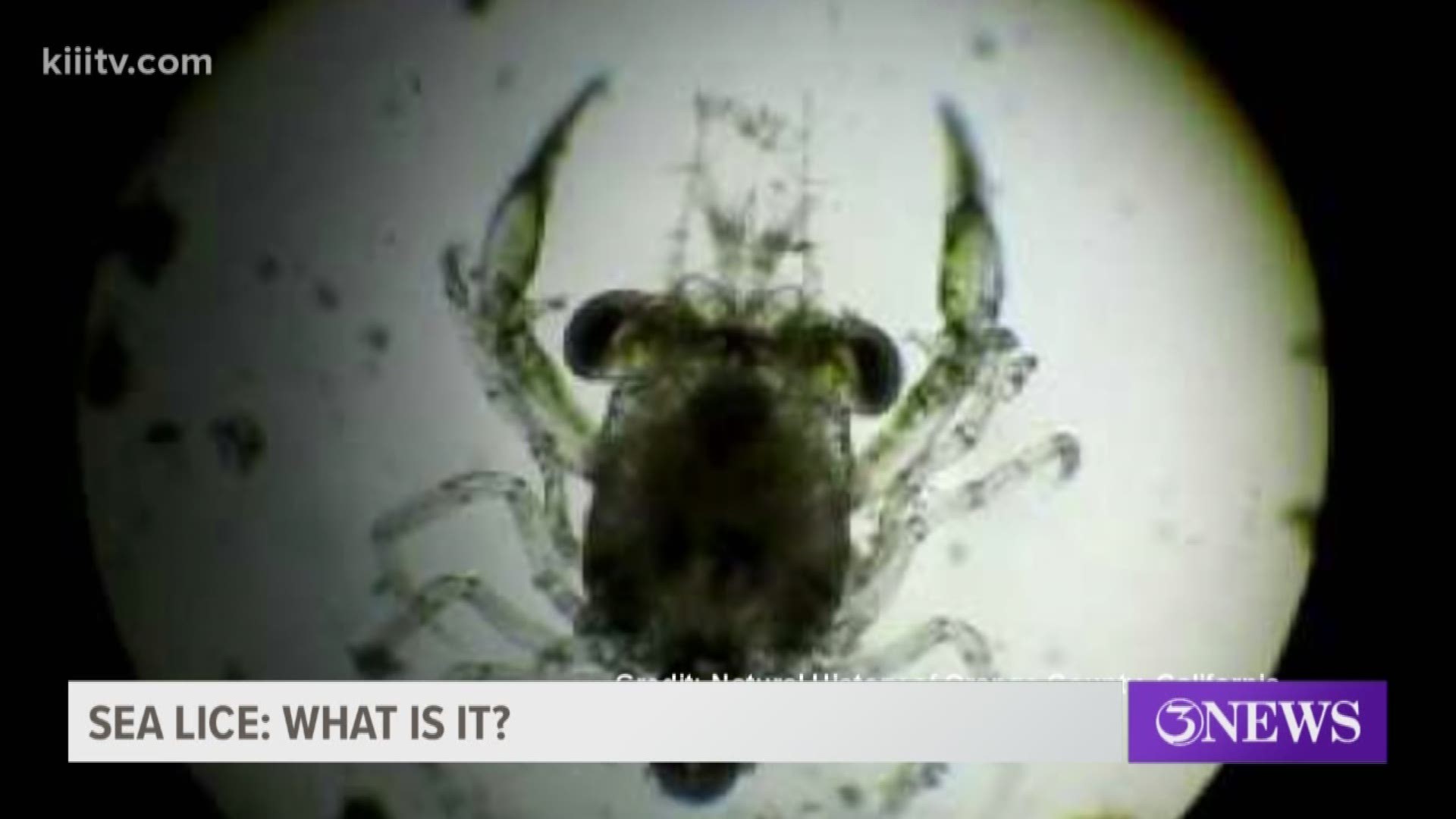 Sea lice have been a big concern for beachgoers in the Coastal Bend recently. Experts said strong currents are bringing them closer to shore, but in many cases, it's not even sea lice that are the problem.