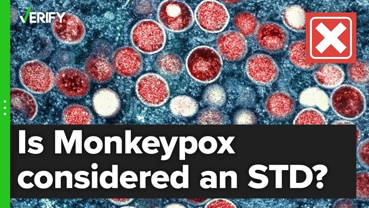 Is Monkeypox a sexually transmitted disease?