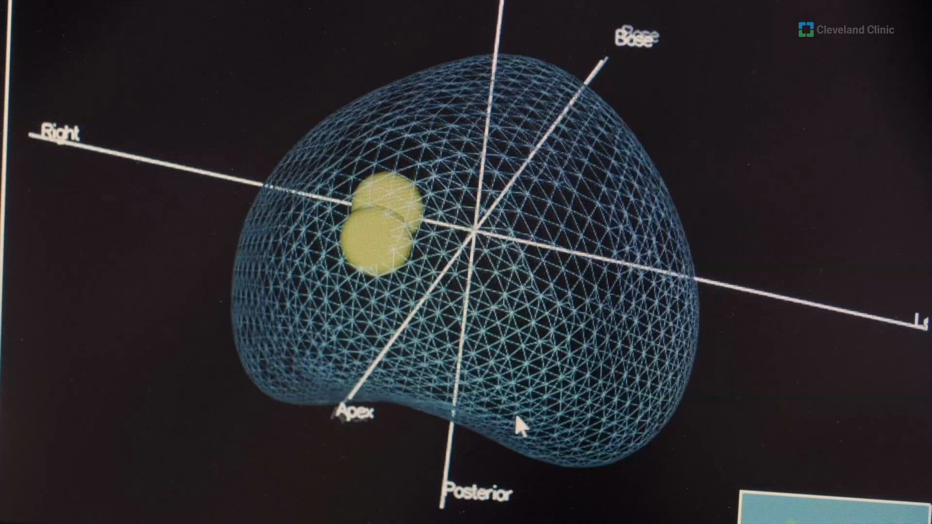 AI helps diagnose prostate cancer, but can it answer parents' health questions?