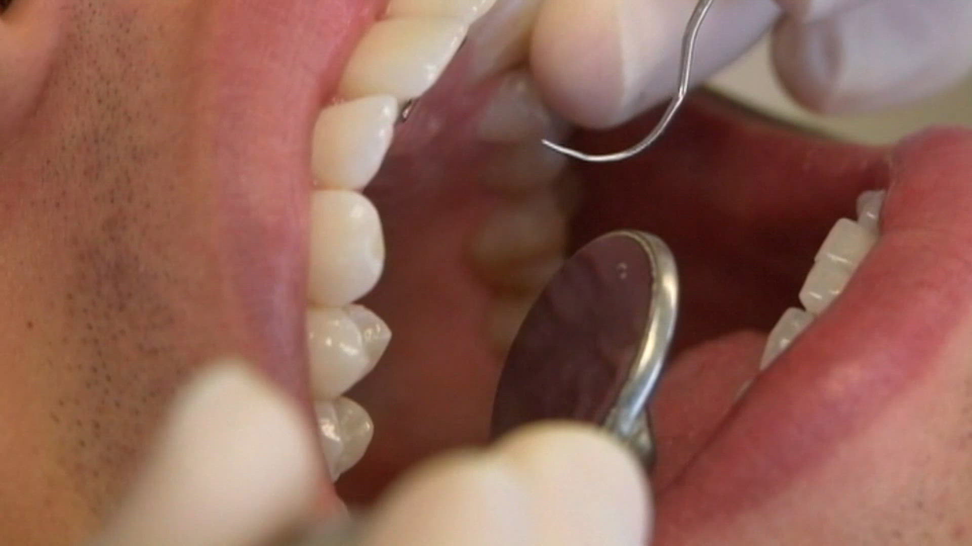 New oral cancer test, updated heart guidelines and beating the summer heat