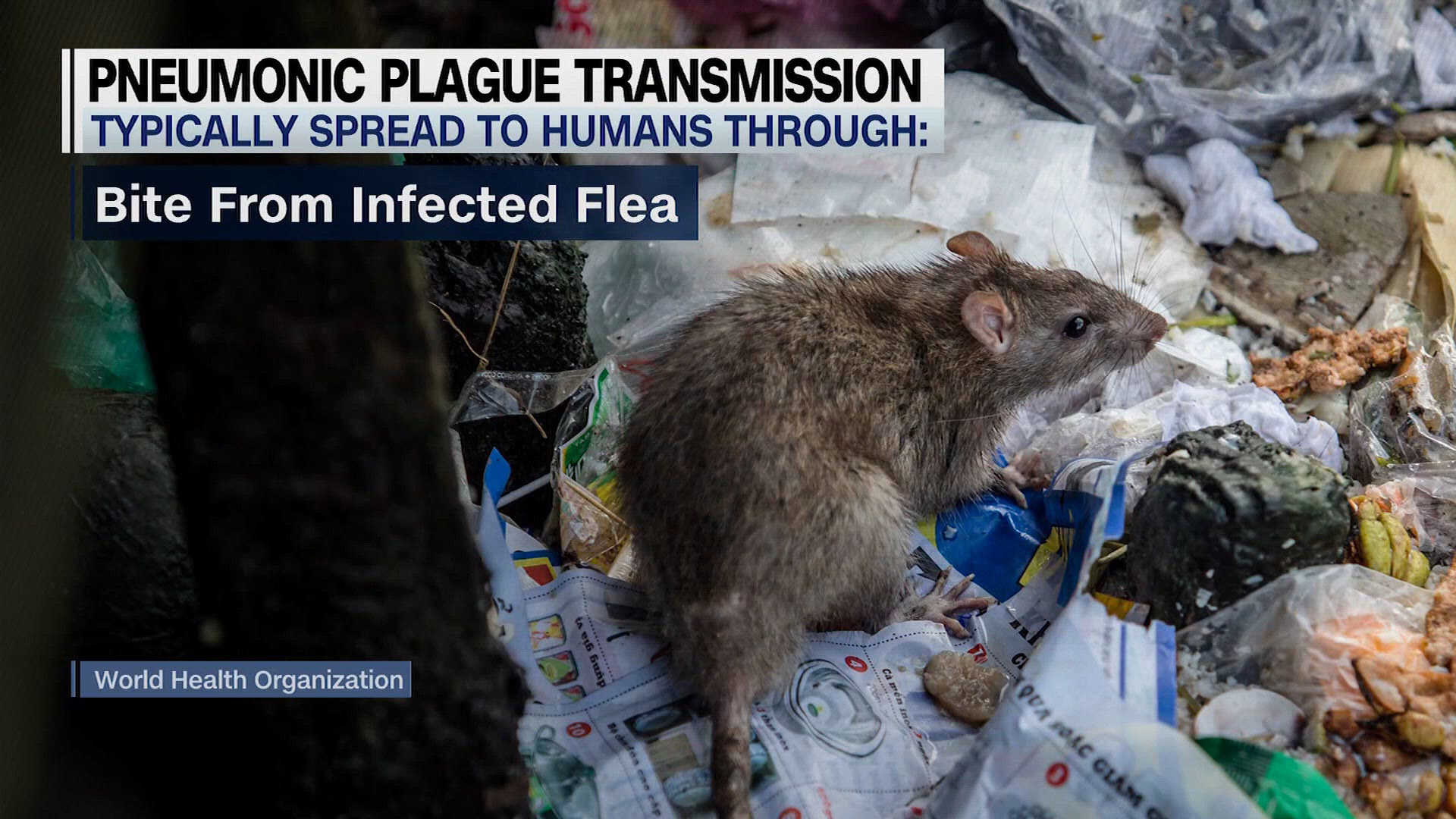 Daily Dose: Pneumonic plague questions, dementia cases set to double and the rising cost of a hospital stay