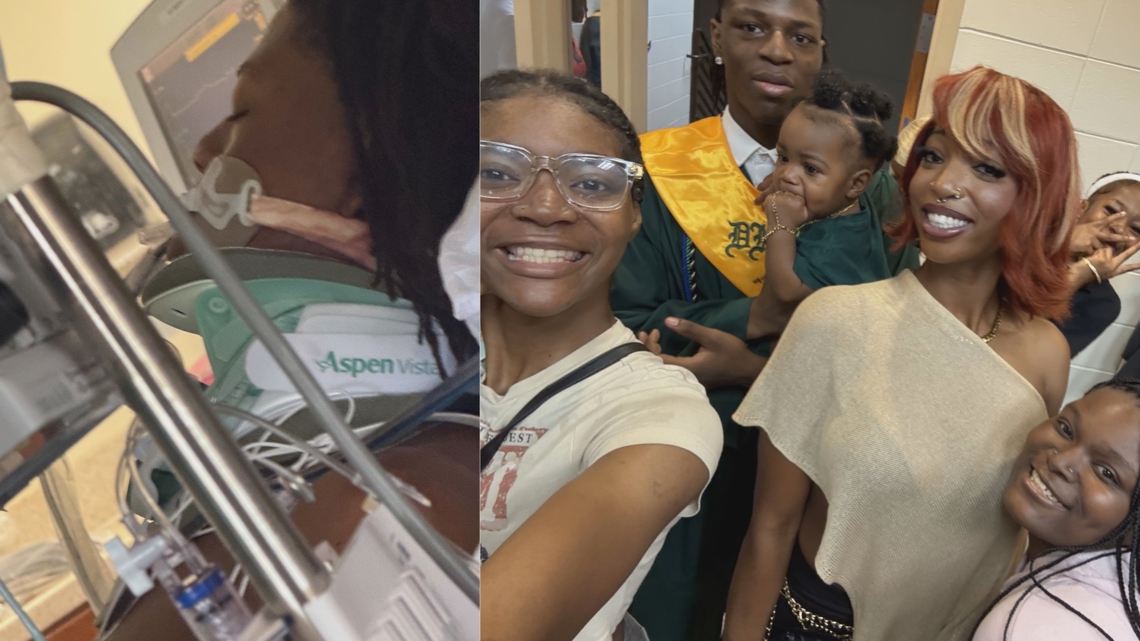 From life support to graduation | Georgia teen survives shooting, walks stage with bullet still lodged in cheek